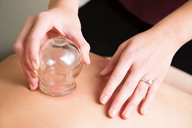 Best Physiotherapy Cupping Therapy Clinics Services in Madurai, Best Physiotherapy Cupping Therapy Center in Madurai
