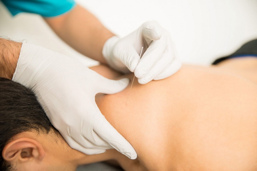 Best Physiotherapy Dry Needling Clinics Services in Madurai, Best Physiotherapy Dry Needling Center in Madurai