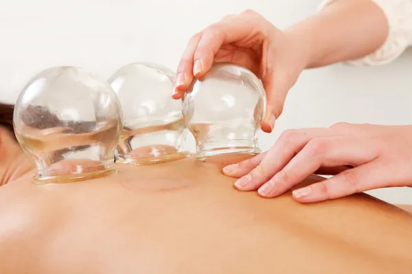 Best Physiotherapy Cupping Therapy Clinics Services in Madurai, Best Physiotherapy Cupping Therapy Center in Madurai